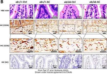 Anti-CD36 antibody [C1C3] used in IHC (Paraffin sections) (IHC-P). GTX100642