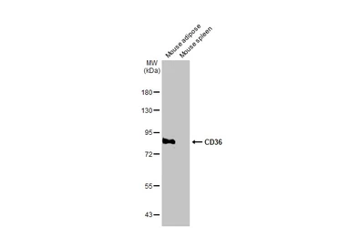 Anti-CD36 antibody [C1C3] used in Western Blot (WB). GTX100642