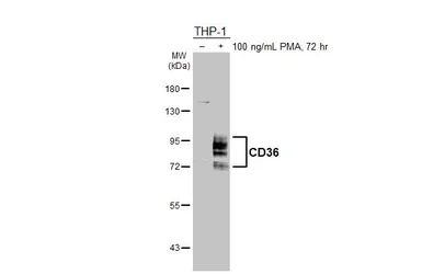 Anti-CD36 antibody [C1C3] used in Western Blot (WB). GTX100642