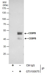 Anti-C/EBP beta antibody used in Immunoprecipitation (IP). GTX100675