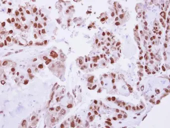 Anti-C/EBP beta antibody used in IHC (Paraffin sections) (IHC-P). GTX100675
