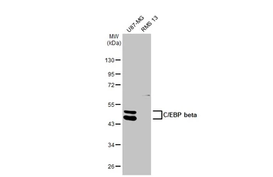 Anti-C/EBP beta antibody used in Western Blot (WB). GTX100675