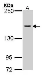 Anti-Topoisomerase II alpha antibody [C3], C-term used in Western Blot (WB). GTX100689