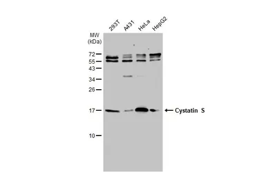 Anti-Cystatin S antibody [N1N3] used in Western Blot (WB). GTX100690