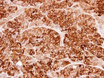 Anti-Cystatin S antibody [N1N3] used in IHC (Paraffin sections) (IHC-P). GTX100690