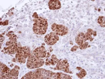 Anti-S100A11 antibody used in IHC (Paraffin sections) (IHC-P). GTX100698