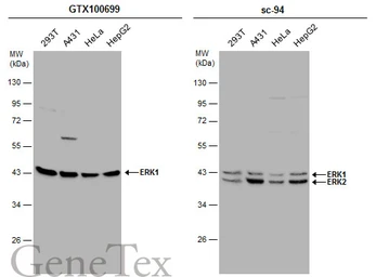 Anti-ERK1 antibody used in Western Blot (WB). GTX100699