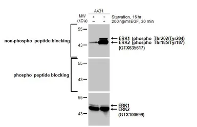 Anti-ERK1 antibody used in Western Blot (WB). GTX100699