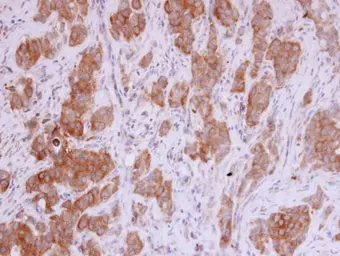 Anti-MMP12 antibody [N3C1], Internal used in IHC (Paraffin sections) (IHC-P). GTX100704