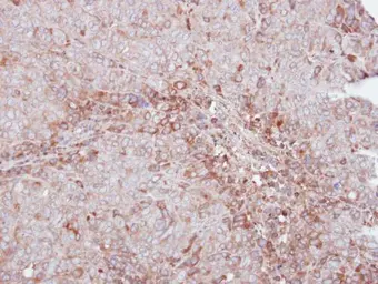 Anti-MMP12 antibody [N3C1], Internal used in IHC (Paraffin sections) (IHC-P). GTX100704