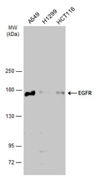 Anti-EGFR antibody [N1], N-term used in Western Blot (WB). GTX100725