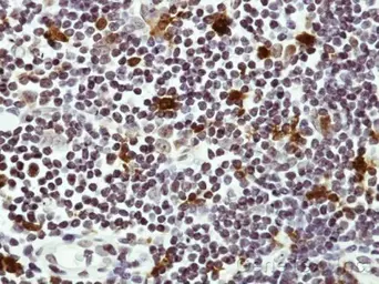 Anti-Hice1 antibody used in IHC (Paraffin sections) (IHC-P). GTX100735