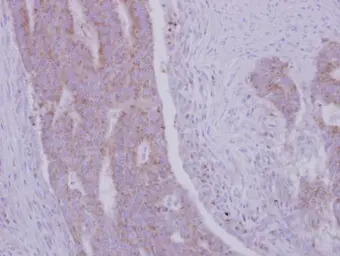 Anti-RRM1 antibody used in IHC (Paraffin sections) (IHC-P). GTX100758