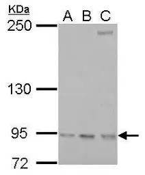 Anti-RRM1 antibody used in Western Blot (WB). GTX100758