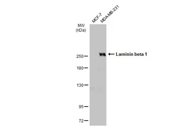 Anti-Laminin beta 1 antibody used in Western Blot (WB). GTX100787