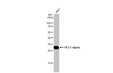 Anti-14-3-3 sigma antibody used in Western Blot (WB). GTX100801