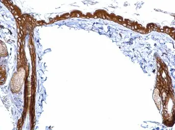 Anti-14-3-3 sigma antibody used in IHC (Paraffin sections) (IHC-P). GTX100801