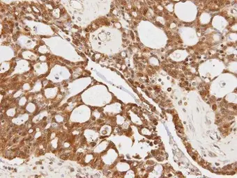 Anti-14-3-3 sigma antibody used in IHC (Paraffin sections) (IHC-P). GTX100801