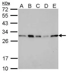 Anti-14-3-3 sigma antibody used in Western Blot (WB). GTX100801