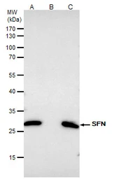 Anti-14-3-3 sigma antibody used in Immunoprecipitation (IP). GTX100801