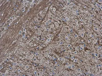 Anti-Collagen II antibody [N1], N-term used in IHC (Paraffin sections) (IHC-P). GTX100829