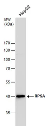 Anti-RPSA antibody [N1C3] used in Western Blot (WB). GTX100831
