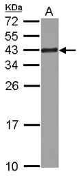 Anti-RPSA antibody [N1C3] used in Western Blot (WB). GTX100831