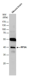 Anti-RPSA antibody [N1C3] used in Western Blot (WB). GTX100831
