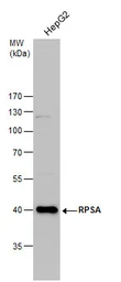 Anti-RPSA antibody [N1C3] used in Western Blot (WB). GTX100831