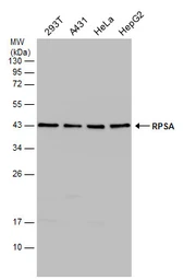 Anti-RPSA antibody [N1C3] used in Western Blot (WB). GTX100831