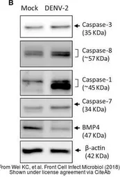 Anti-BMP4 antibody used in Western Blot (WB). GTX100875