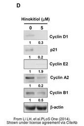 Anti-Cyclin B1 antibody used in Western Blot (WB). GTX100911