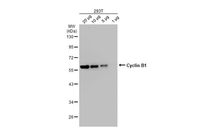 Anti-Cyclin B1 antibody used in Western Blot (WB). GTX100911