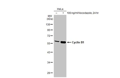 Anti-Cyclin B1 antibody used in Western Blot (WB). GTX100911