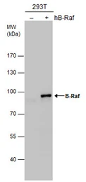 Anti-B-Raf antibody [N2C1], Internal used in Western Blot (WB). GTX100913