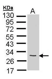 Anti-FGF10 antibody used in Western Blot (WB). GTX101005