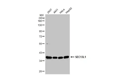 Anti-SEC13L1 antibody [N1C3] used in Western Blot (WB). GTX101055