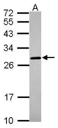 Anti-Prion Protein (PrP) antibody used in Western Blot (WB). GTX101063