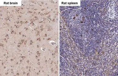 Anti-PSAP antibody [N1N3] used in IHC (Paraffin sections) (IHC-P). GTX101064