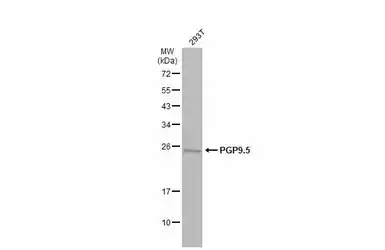 Anti-PGP9.5 antibody used in Western Blot (WB). GTX101093