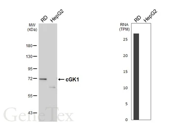 Anti-cGK1 antibody used in Western Blot (WB). GTX101096