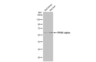 Anti-PPAR alpha antibody used in Western Blot (WB). GTX101098