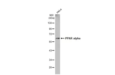 Anti-PPAR alpha antibody used in Western Blot (WB). GTX101098