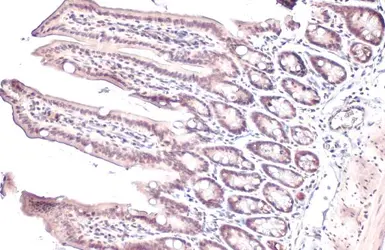 Anti-PPAR alpha antibody used in IHC (Paraffin sections) (IHC-P). GTX101098