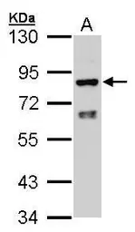 Anti-POR antibody [N2C2], Internal used in Western Blot (WB). GTX101100