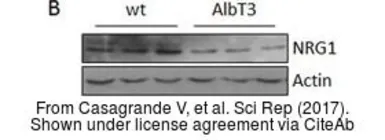 Anti-Neuregulin-1 antibody used in Western Blot (WB). GTX101117