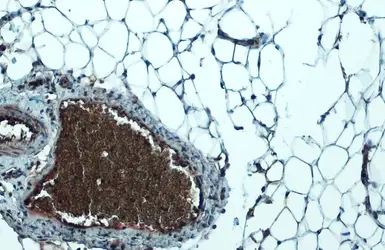 Anti-LPL antibody used in IHC (Paraffin sections) (IHC-P). GTX101125