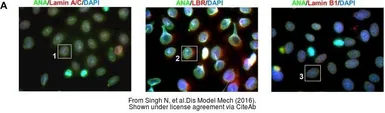 Anti-Lamin A + C antibody used in Immunocytochemistry/ Immunofluorescence (ICC/IF). GTX101127