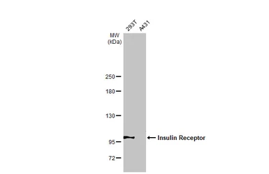 Anti-Insulin Receptor beta antibody used in Western Blot (WB). GTX101136