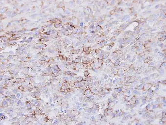 Anti-CD73 antibody [N3C3] used in IHC (Paraffin sections) (IHC-P). GTX101140